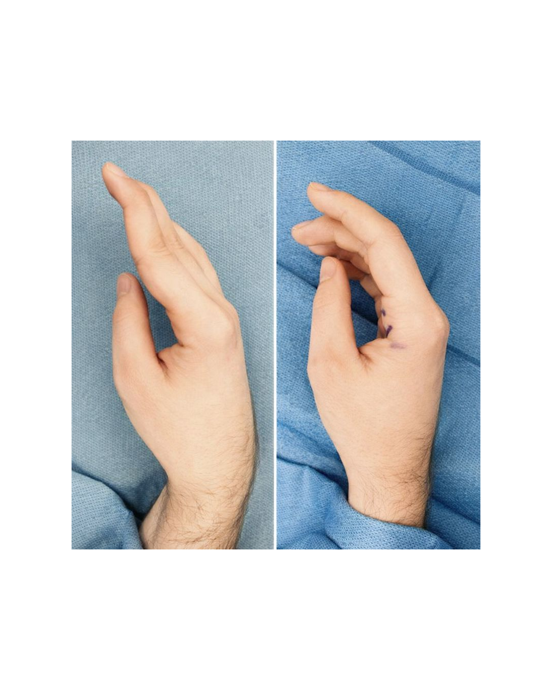 Posters Design - Sample 2 - Before